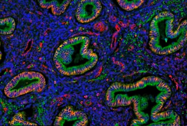 Endometrium cell types A fluorescently labeled image of endometrium