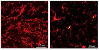 Microscope images of microglia (red)