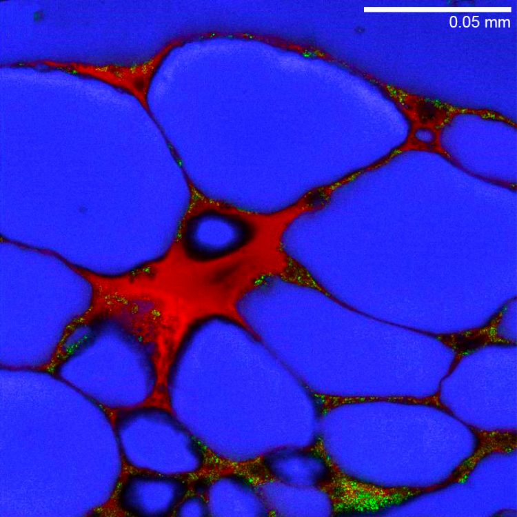 Detail of a pseudoinclusion under a fluorescence microscope